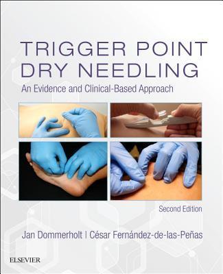 Cover: 9780702074165 | Trigger Point Dry Needling | An Evidence and Clinical-Based Approach