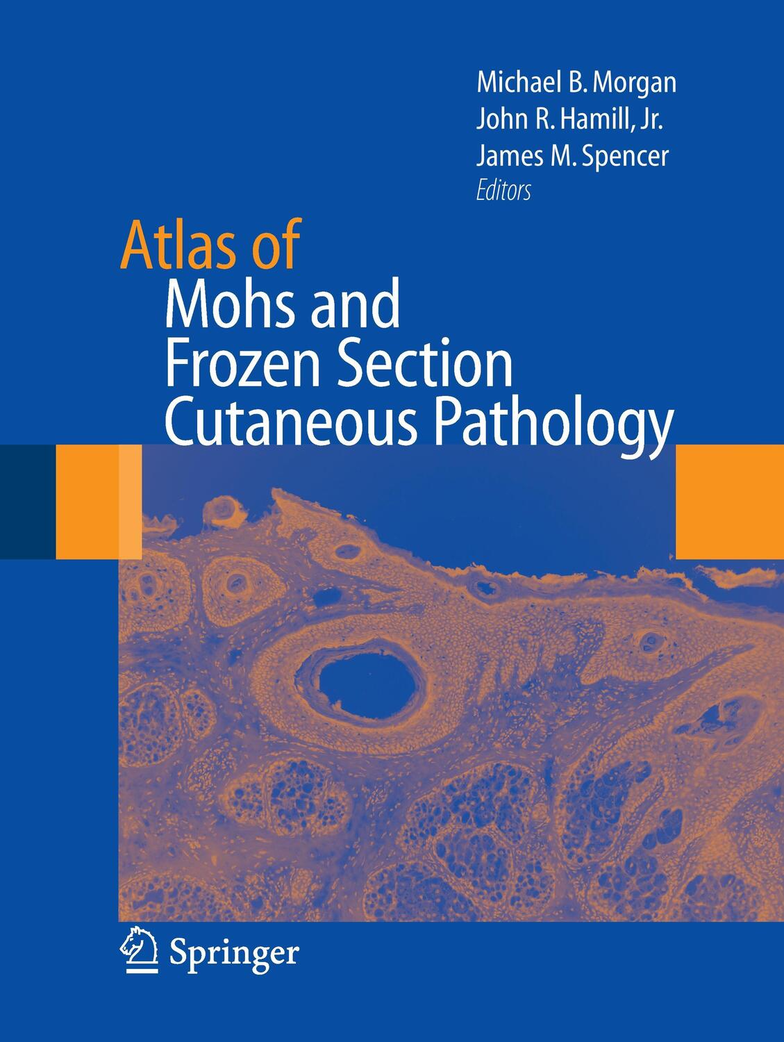 Cover: 9781493950683 | Atlas of Mohs and Frozen Section Cutaneous Pathology | Morgan (u. a.)