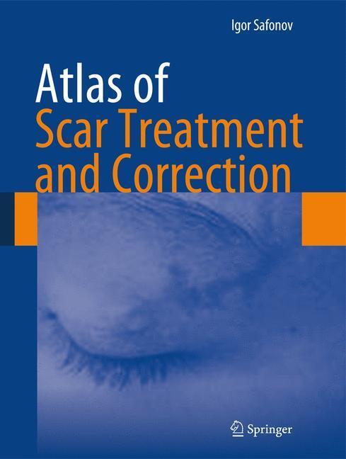 Cover: 9783642291951 | Atlas of Scar Treatment and Correction | Igor Safonov | Buch | VIII