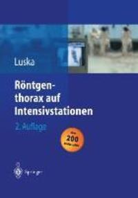 Cover: 9783642623271 | Röntgenthorax auf Intensivstationen | Günter Luska | Taschenbuch