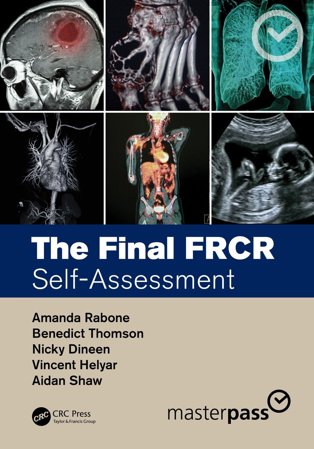 Cover: 9781482259742 | The Final FRCR | Self-Assessment | Aidan Shaw (u. a.) | Taschenbuch