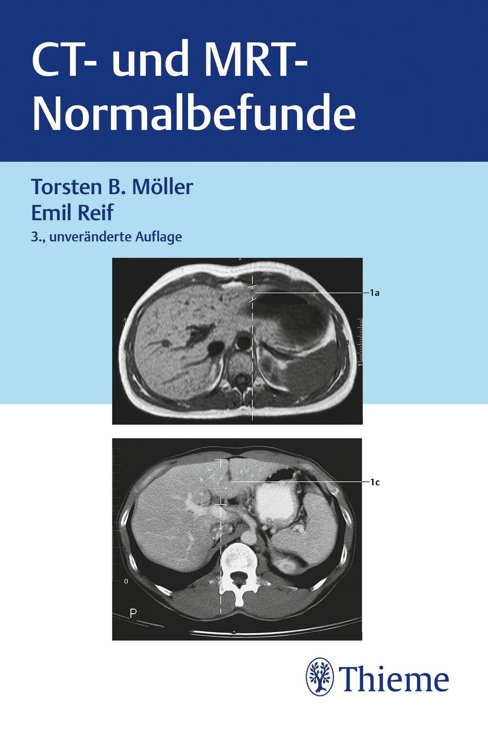 Cover: 9783132453074 | CT und MRT Normalbefunde | Torsten Bert Möller (u. a.) | Taschenbuch