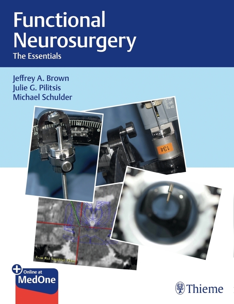 Cover: 9781626237742 | Functional Neurosurgery | The Essentials. Plus Online at MedOne | 2019