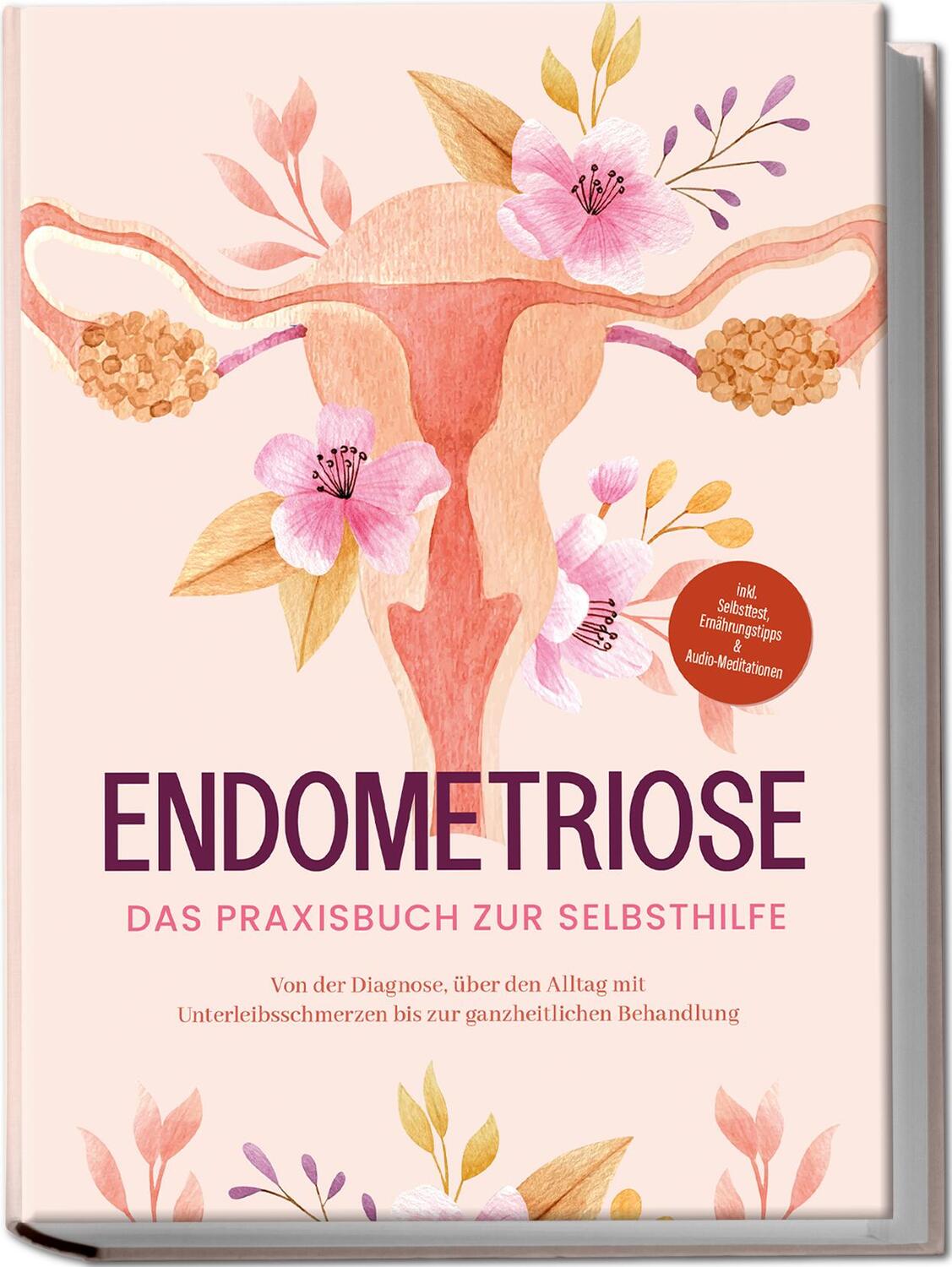 Cover: 9783969304471 | Endometriose - Das Praxisbuch zur Selbsthilfe: Von der Diagnose,...