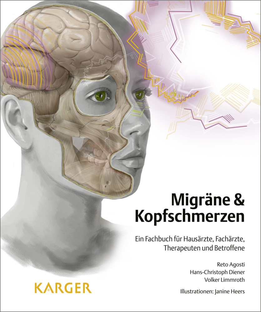 Cover: 9783318054415 | Migräne &amp; Kopfschmerzen | Reto Agosti (u. a.) | Buch | 416 S. | 2015