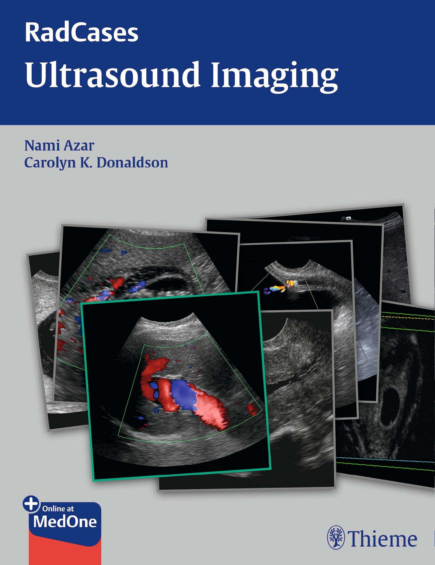 Cover: 9781604063226 | Radcases Ultrasound Imaging | Nami R Azar (u. a.) | Taschenbuch | 2015