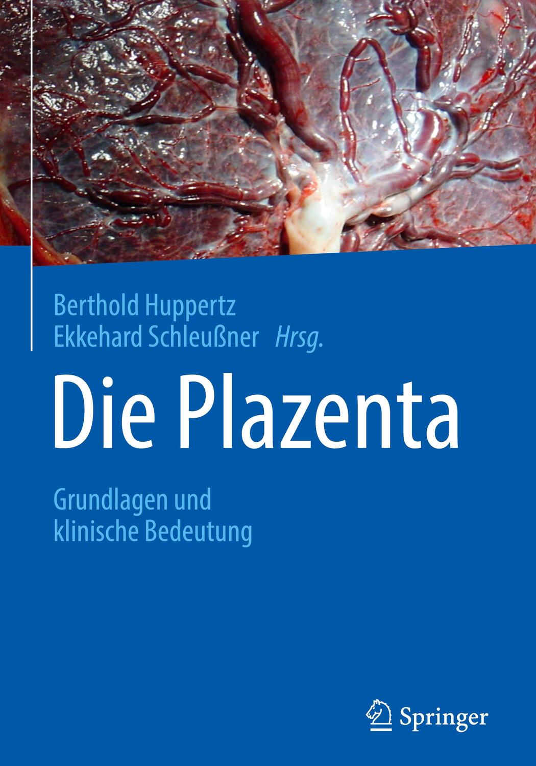 Cover: 9783662556214 | Die Plazenta | Grundlagen und klinische Bedeutung | Huppertz (u. a.)