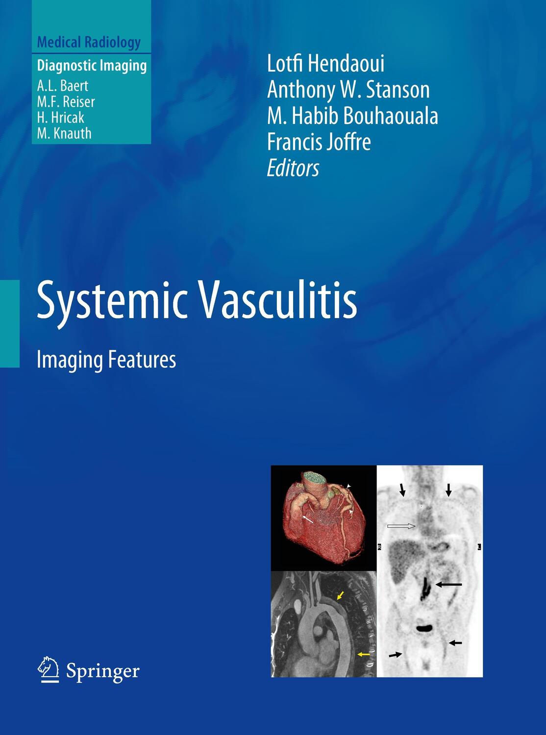 Cover: 9783642448485 | Systemic Vasculitis | Imaging Features | Lotfi Hendaoui (u. a.) | Buch