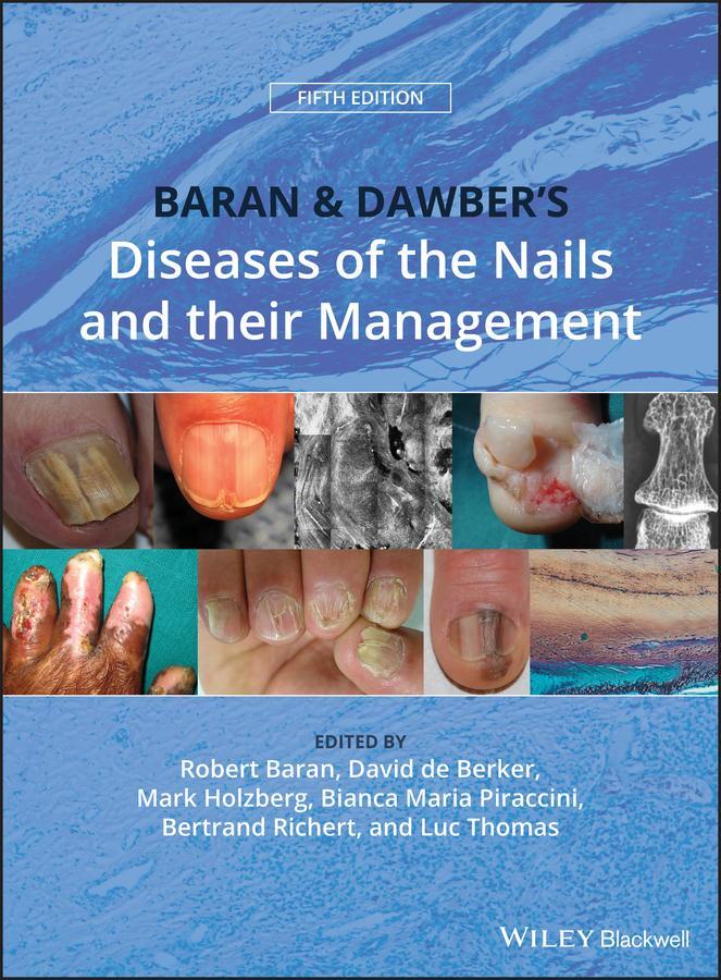 Cover: 9781119323358 | Baran and Dawber's Diseases of the Nails and Their Management | Buch