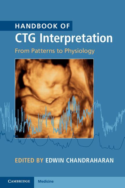 Cover: 9781107485501 | Handbook of CTG Interpretation | Edwin Chandraharan | Taschenbuch