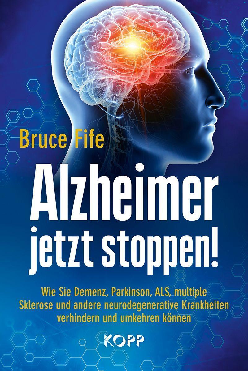 Cover: 9783864458880 | Alzheimer jetzt stoppen! | Bruce Fife | Buch | 559 S. | Deutsch | 2020