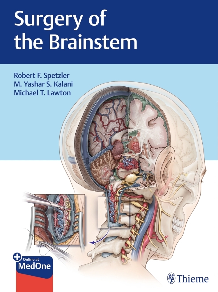 Cover: 9781626232914 | Surgery of the Brainstem | Robert F. Spetzler (u. a.) | Bundle | 2020