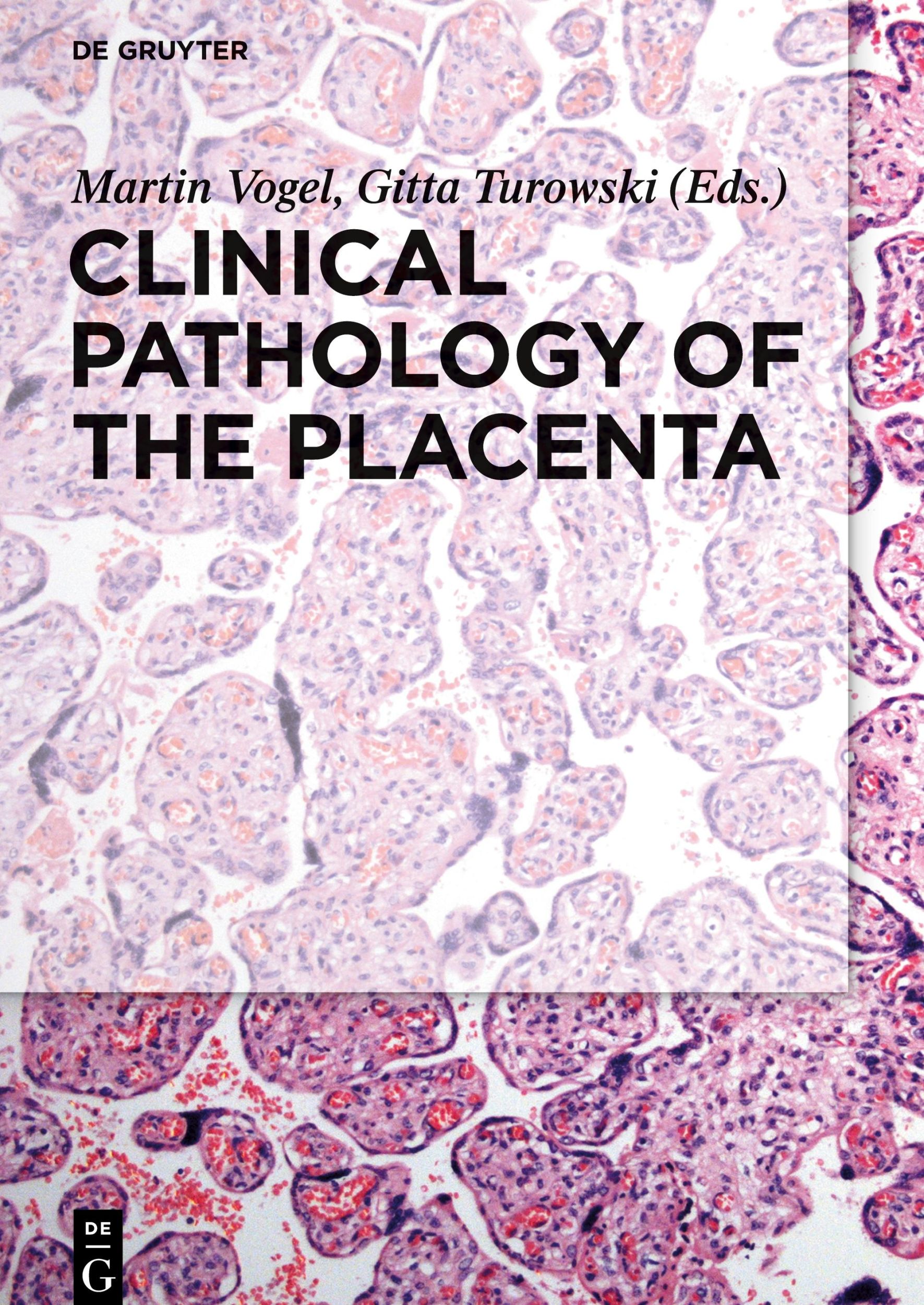 Cover: 9783110449976 | Clinical Pathology of the Placenta | Martin Vogel (u. a.) | Buch | XVI