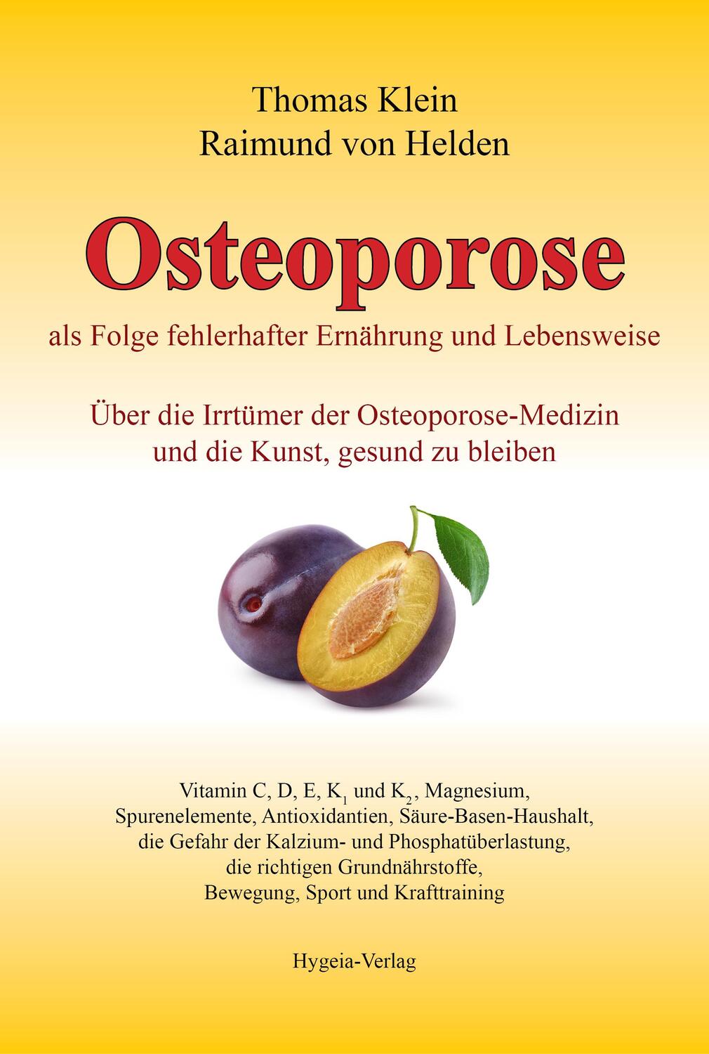 Cover: 9783939865148 | Osteoporose | Thomas Klein (u. a.) | Buch | 775 S. | Deutsch | 2015