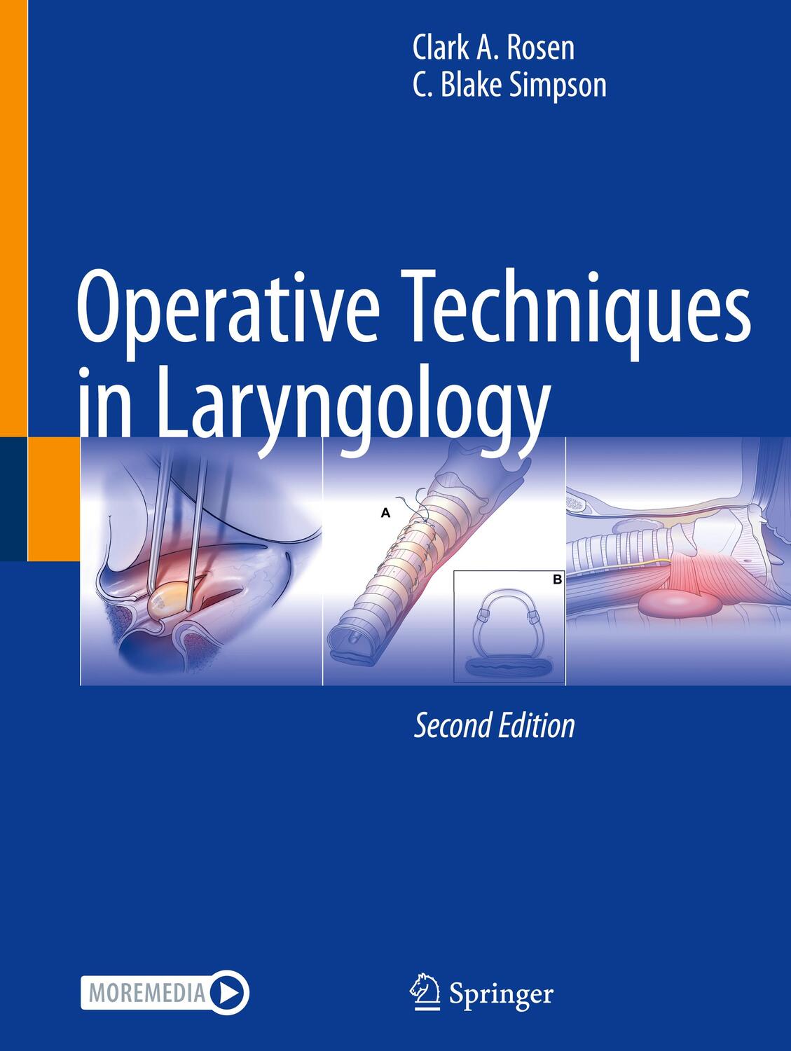 Cover: 9783031343537 | Operative Techniques in Laryngology | C. Blake Simpson (u. a.) | Buch