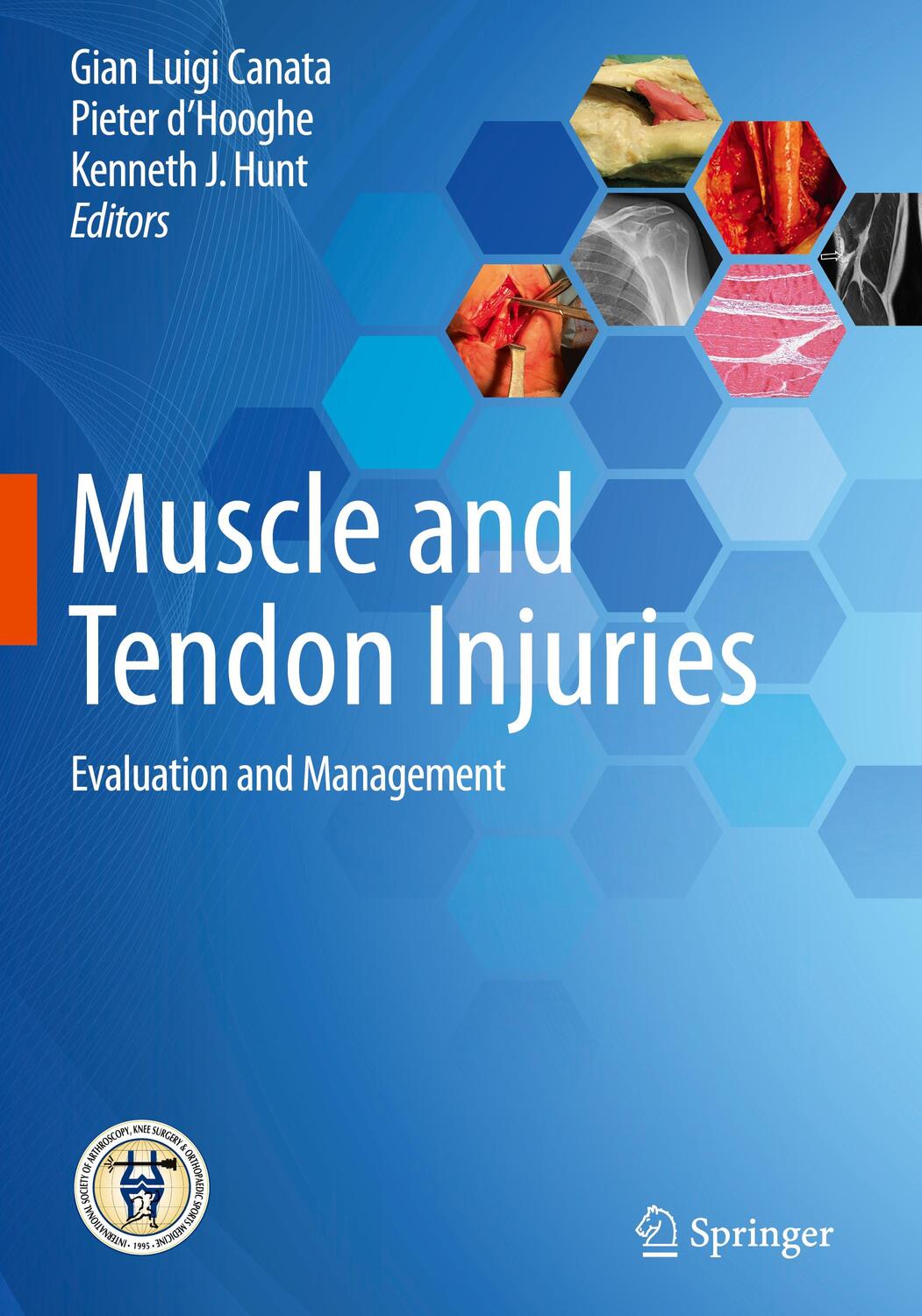 Cover: 9783662541838 | Muscle and Tendon Injuries | Evaluation and Management | Buch | 2017