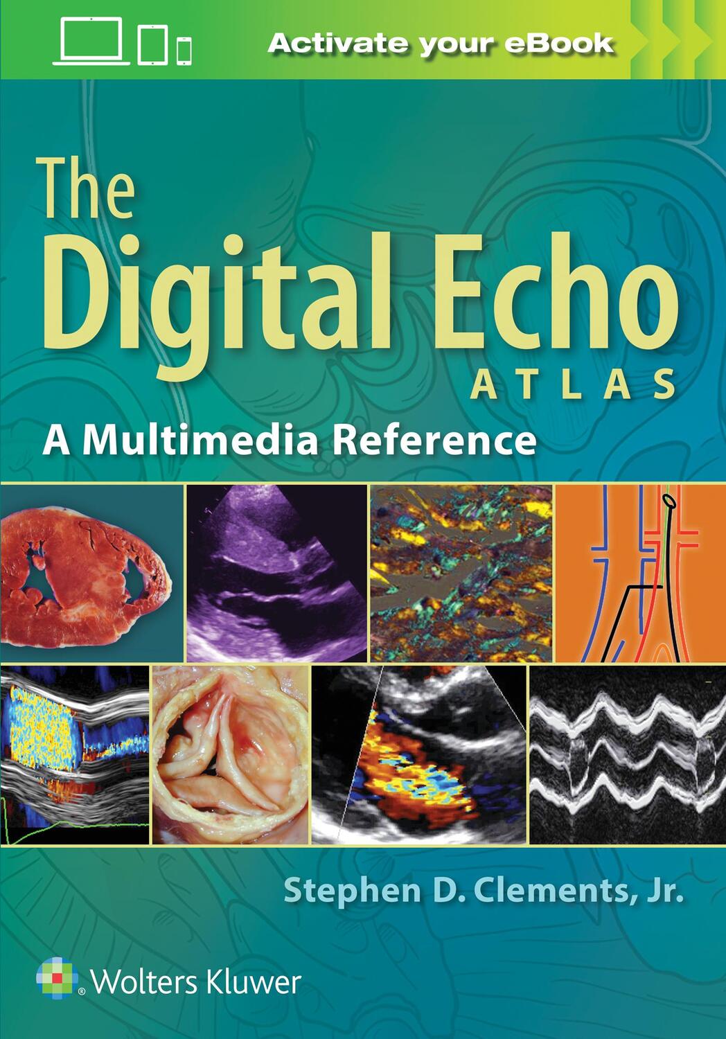 Cover: 9781496356307 | The Digital Echo Atlas | A Multimedia Reference | Stephen D. Clements