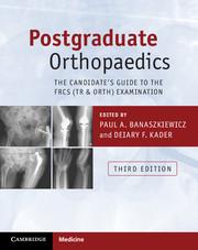 Cover: 9781107451643 | Postgraduate Orthopaedics | Paul A Banaszkiewicz (u. a.) | Taschenbuch