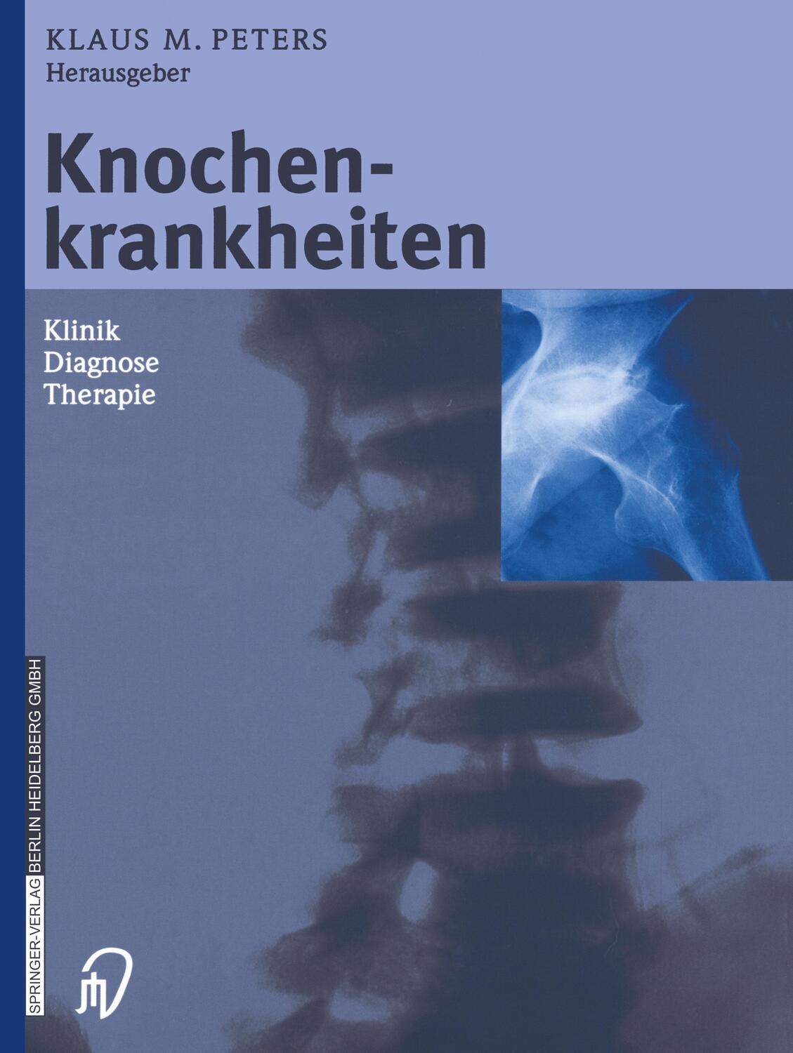 Cover: 9783798513259 | Knochenkrankheiten | Klinik Diagnose Therapie | Klaus M. Peters | Buch
