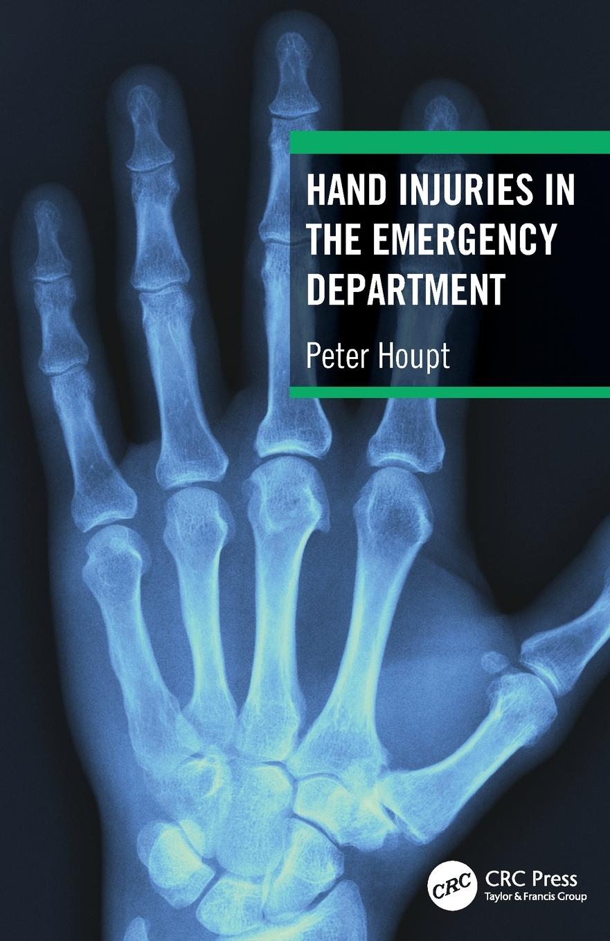 Cover: 9781032322421 | Hand Injuries in the Emergency Department | Peter Houpt | Taschenbuch