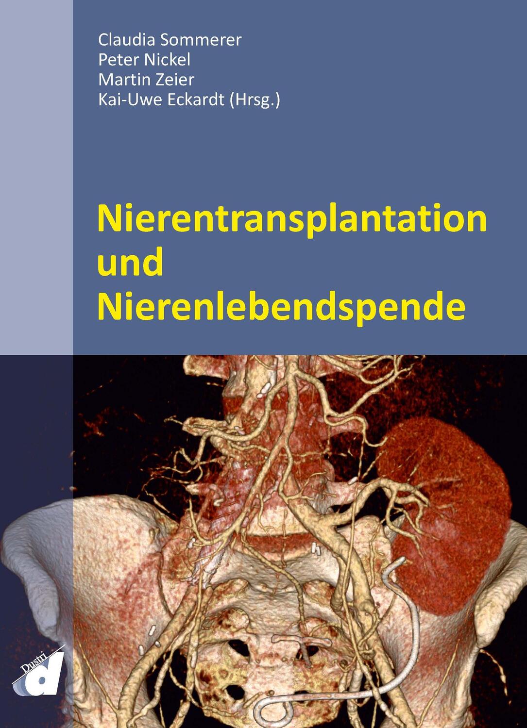 Cover: 9783871855528 | Nierentransplantation und Nierenlebendspende | Sommerer (u. a.) | Buch