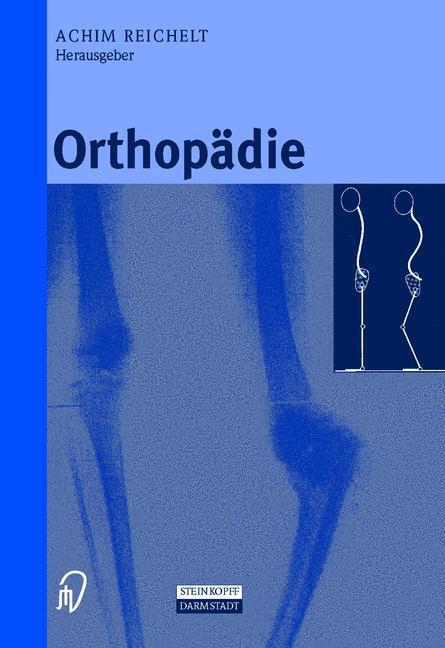Cover: 9783798512269 | Orthopädie | Achim Reichelt | Buch | HC runder Rücken kaschiert | xv