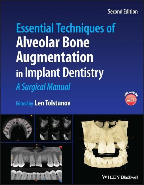 Cover: 9781119827320 | Essential Techniques of Alveolar Bone Augmentation in Implant...