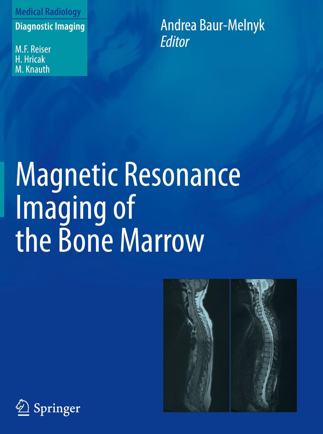 Cover: 9783642178597 | Magnetic Resonance Imaging of the Bone Marrow | Andrea Baur-Melnyk