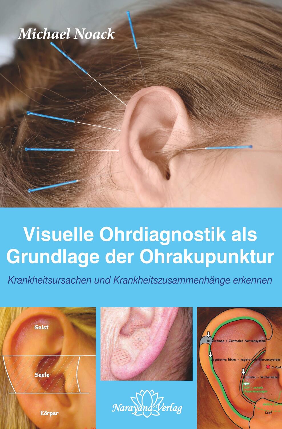Cover: 9783955821784 | Visuelle Ohrdiagnostik als Grundlage der Ohrakupunktur | Michael Noack
