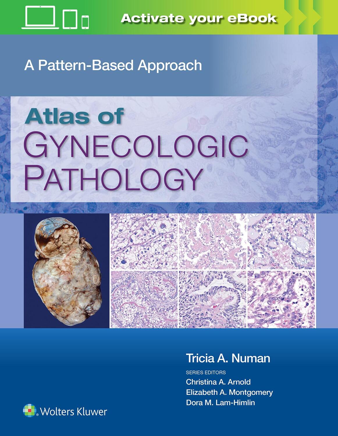 Cover: 9781975124762 | Atlas of Gynecologic Pathology | A Pattern-Based Approach | Numan