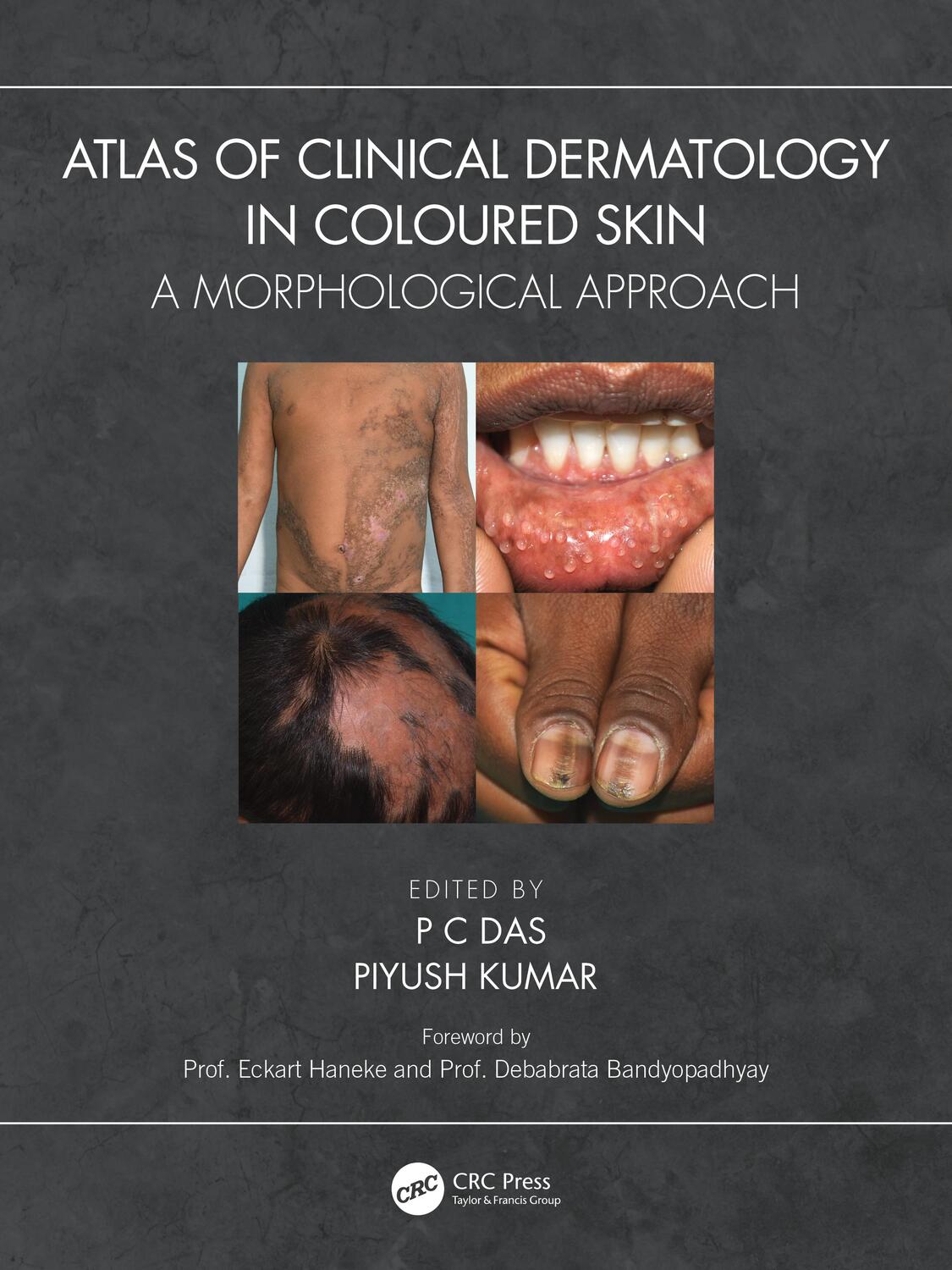 Cover: 9781032399669 | Atlas of Clinical Dermatology in Coloured Skin | P C Das (u. a.)