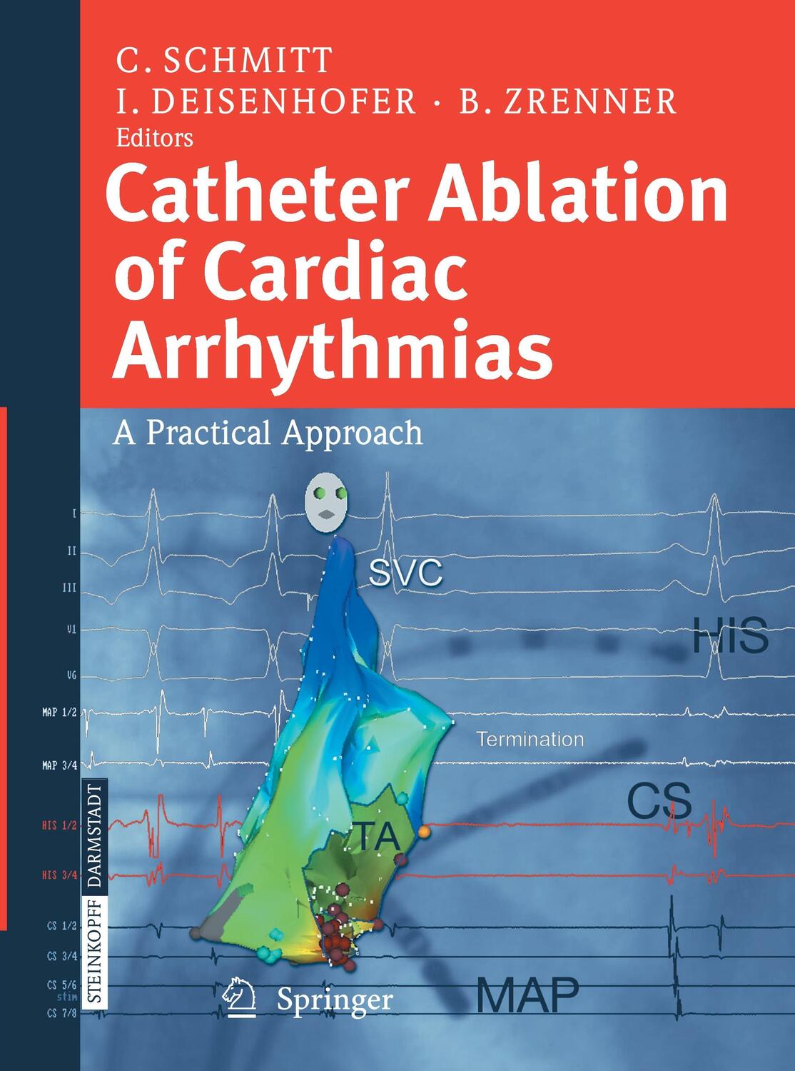 Cover: 9783662526835 | Catheter Ablation of Cardiac Arrhythmias | A Practical Approach | Buch