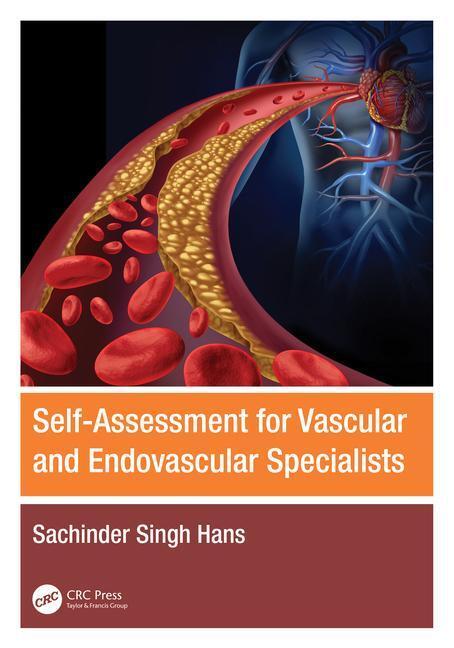 Cover: 9781032485553 | Self-Assessment for Vascular and Endovascular Specialists | Hans