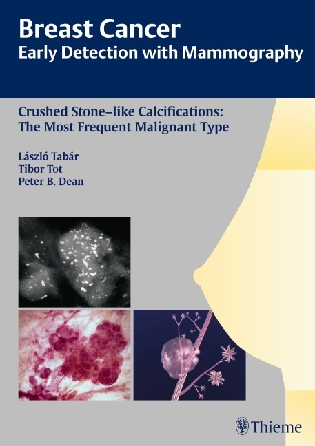Cover: 9783131485311 | Early Detection with Mammography | Laszlo Tabar (u. a.) | Buch | 2008