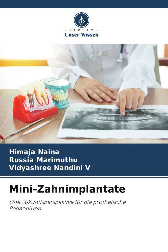 Cover: 9786206859222 | Mini-Zahnimplantate | Himaja Naina (u. a.) | Taschenbuch | Paperback