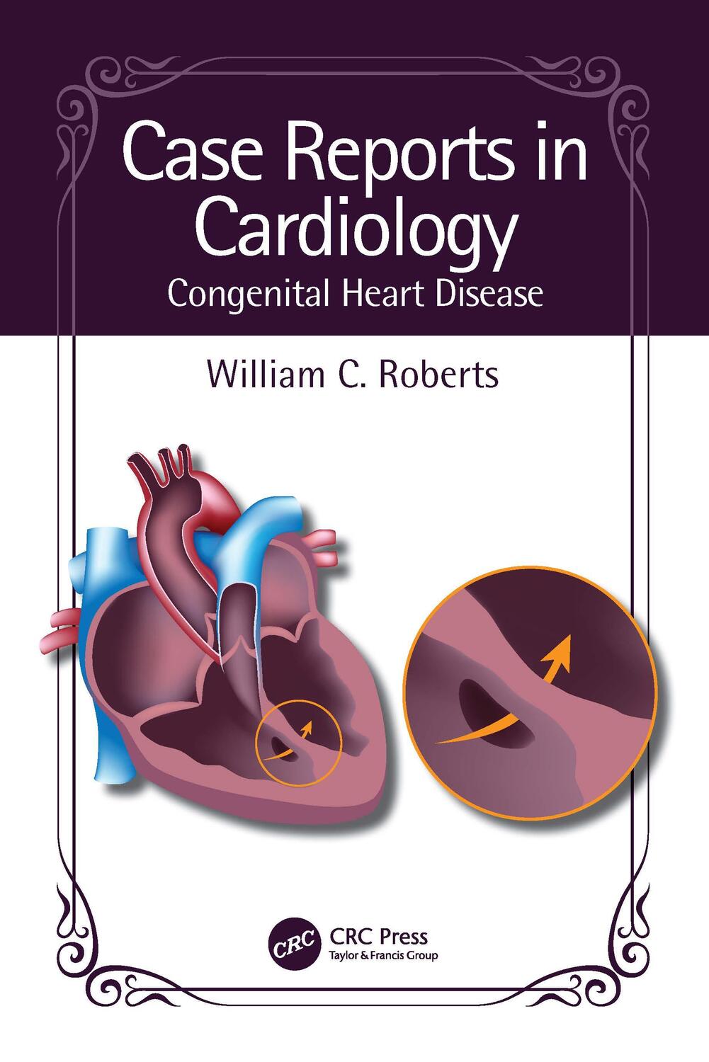 Cover: 9781032529455 | Case Reports in Cardiology | Congenital Heart Disease | Roberts | Buch