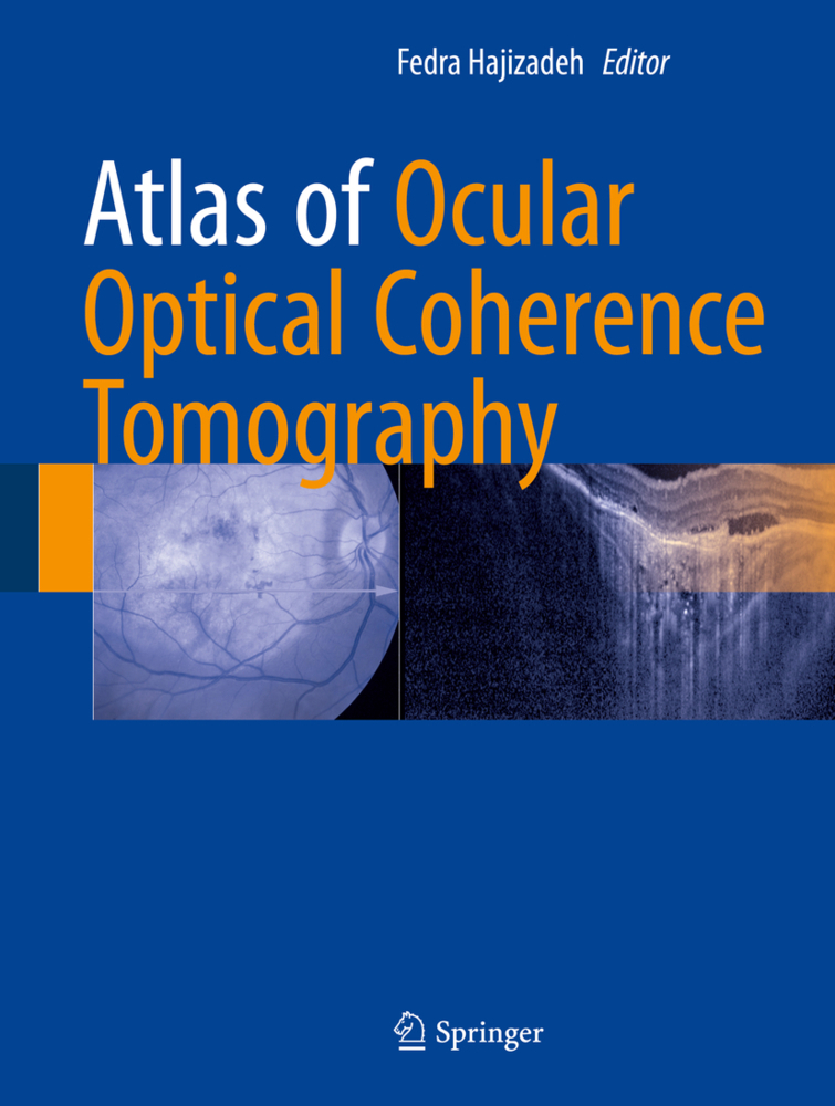 Cover: 9783319667560 | Atlas of Ocular Optical Coherence Tomography | Fedra Hajizadeh | Buch