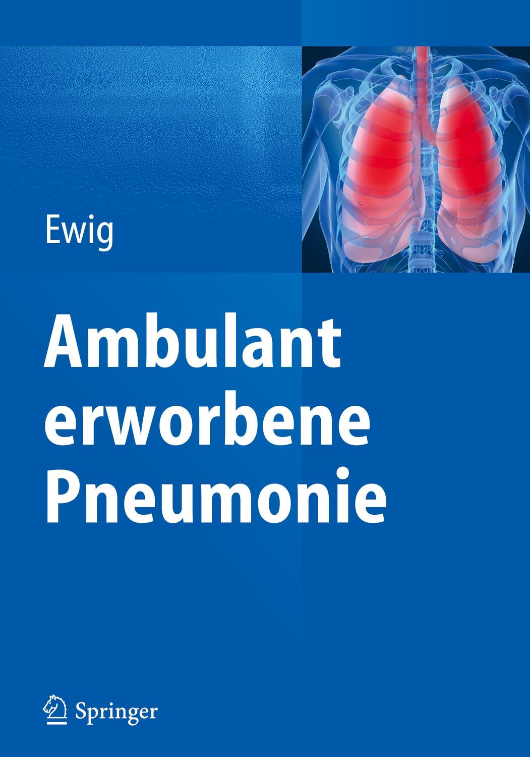 Cover: 9783662473115 | Ambulant erworbene Pneumonie | Santiago Ewig | Buch | Deutsch | 2015