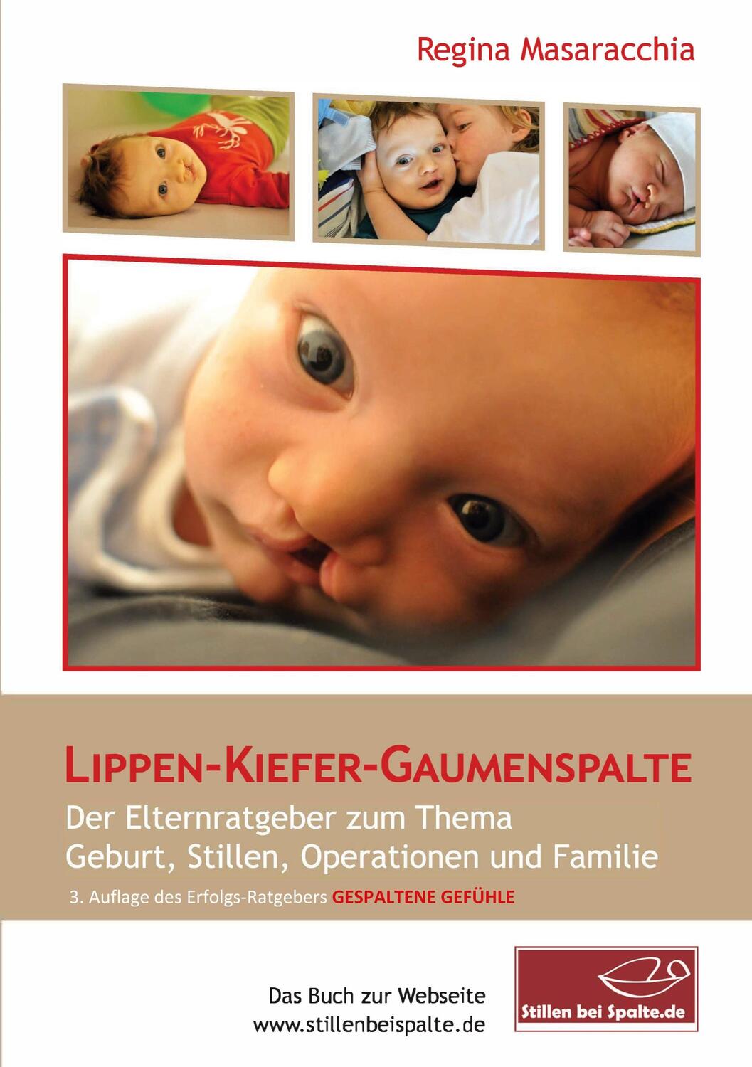 Cover: 9783750446595 | Lippen-Kiefer-Gaumenspalte | Gespaltene Gefühle: 3. Auflage | Buch