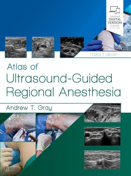 Cover: 9780323509510 | Atlas of Ultrasound-Guided Regional Anesthesia | Andrew T Gray | Buch