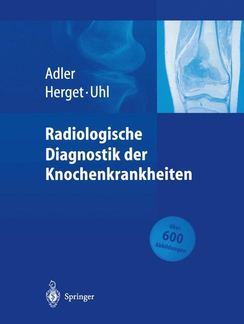 Cover: 9783662096611 | Radiologische Diagnostik der Knochenkrankheiten | Adler (u. a.) | Buch