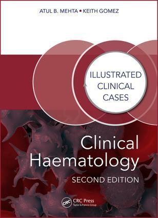 Cover: 9781482243796 | Clinical Haematology | Illustrated Clinical Cases | Mehta (u. a.)