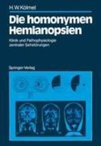Cover: 9783540189749 | Die homonymen Hemianopsien | Hans W. Kölmel | Taschenbuch | Paperback