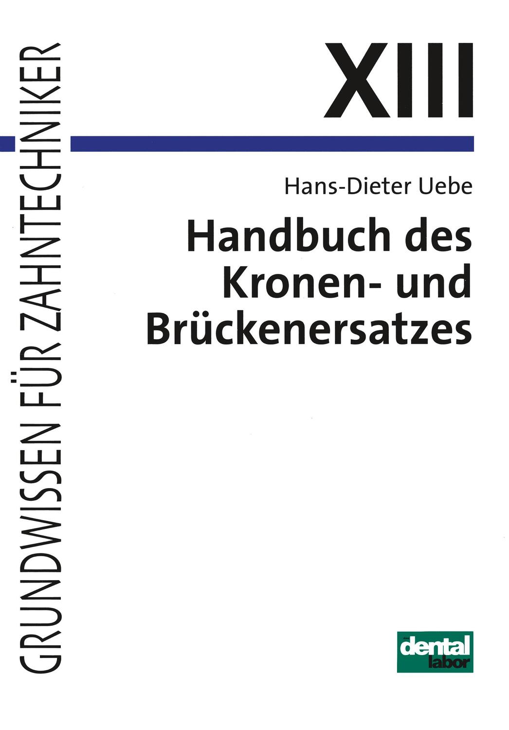 Cover: 9783929360097 | Handbuch des Kronen- und Brückenersatzes | Hans-Dieter Uebe | Buch