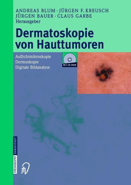 Cover: 9783642632686 | Dermatoskopie von Hauttumoren | A. Blum (u. a.) | Taschenbuch | xvi