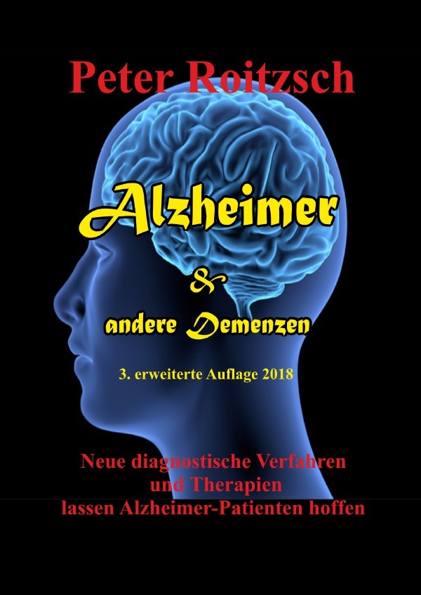 Cover: 9783750208162 | Alzheimer &amp; andere Demenzen | Peter Roitzsch | Taschenbuch | Deutsch