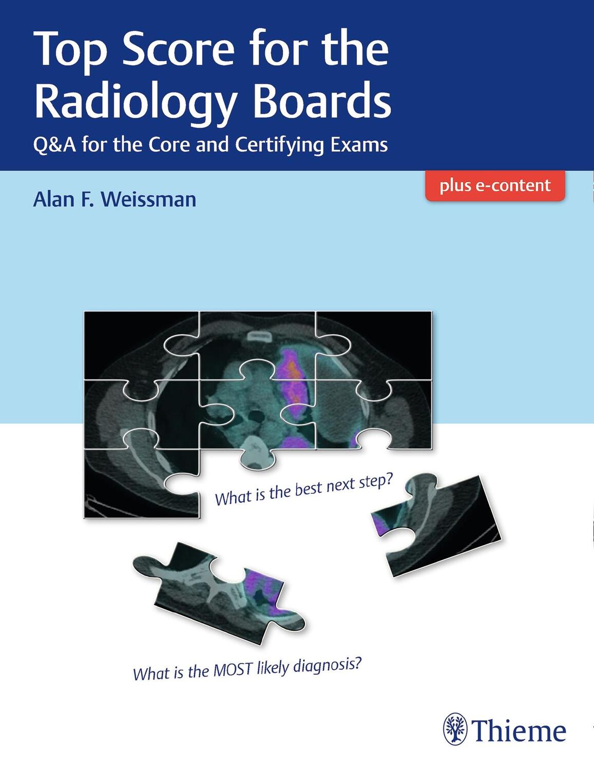 Cover: 9781626234093 | Top Score for the Radiology Boards | Alan Weissman | Taschenbuch