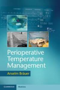 Cover: 9781107535770 | Perioperative Temperature Management | Anselm Bräuer | Taschenbuch