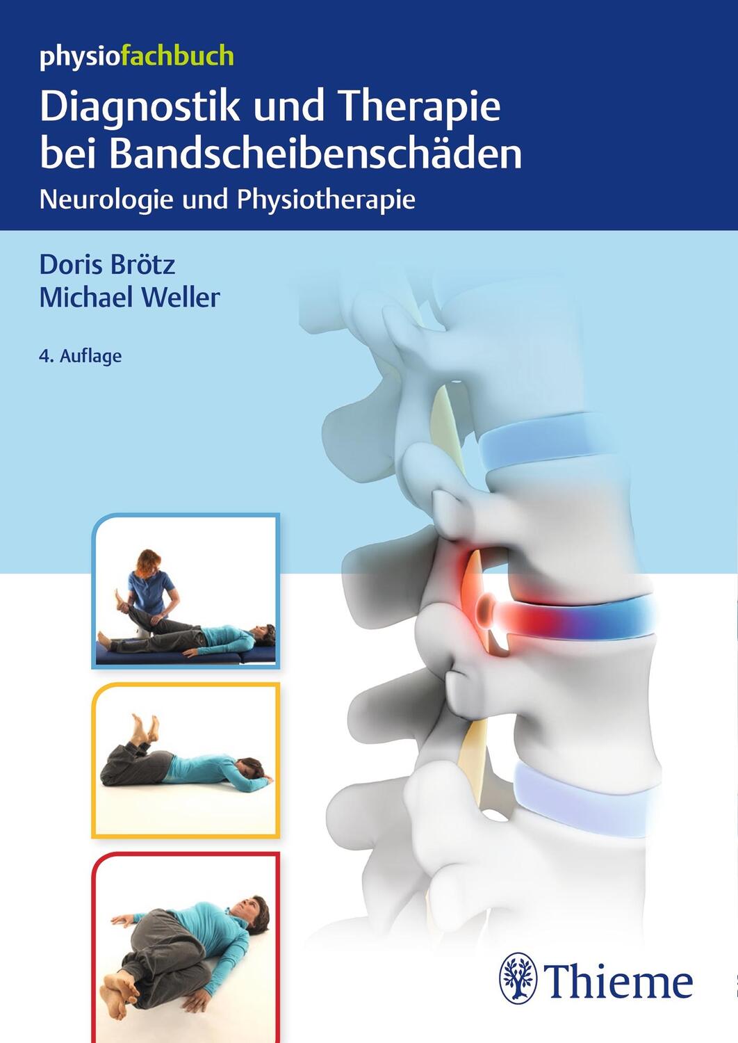 Cover: 9783132401884 | Diagnostik und Therapie bei Bandscheibenschäden | Doris Brötz (u. a.)
