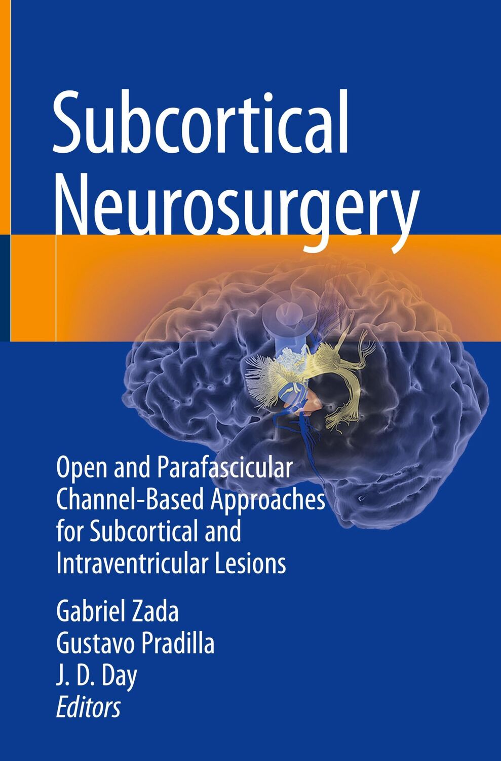 Cover: 9783030951528 | Subcortical Neurosurgery | Gabriel Zada (u. a.) | Buch | xii | 2022